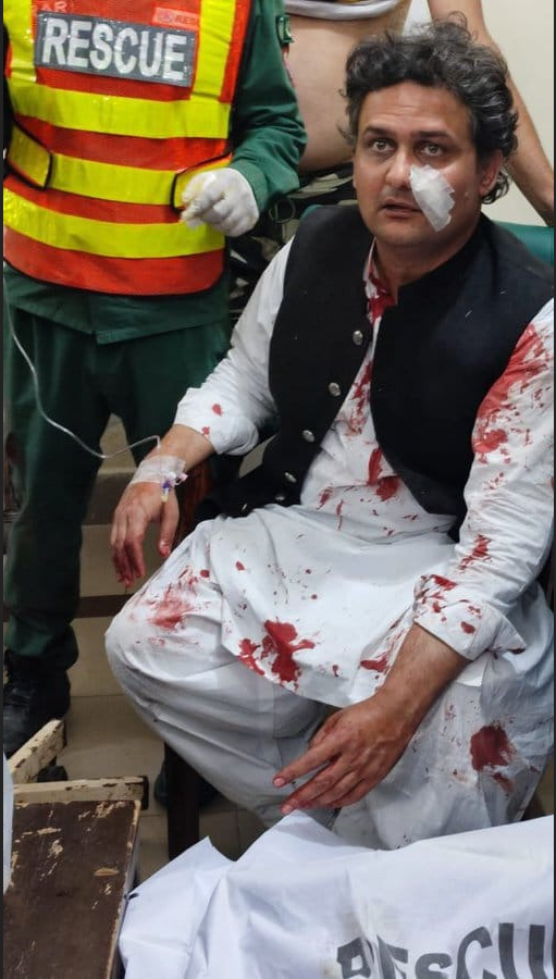 faisal javed injured during pti rally