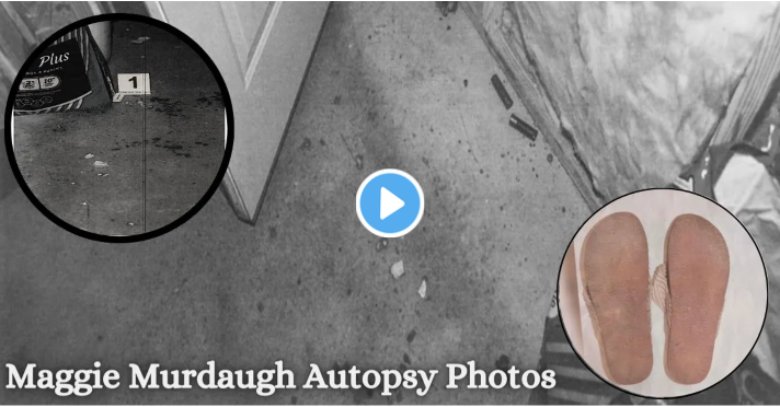 Murdaugh Autopsy Leaked video